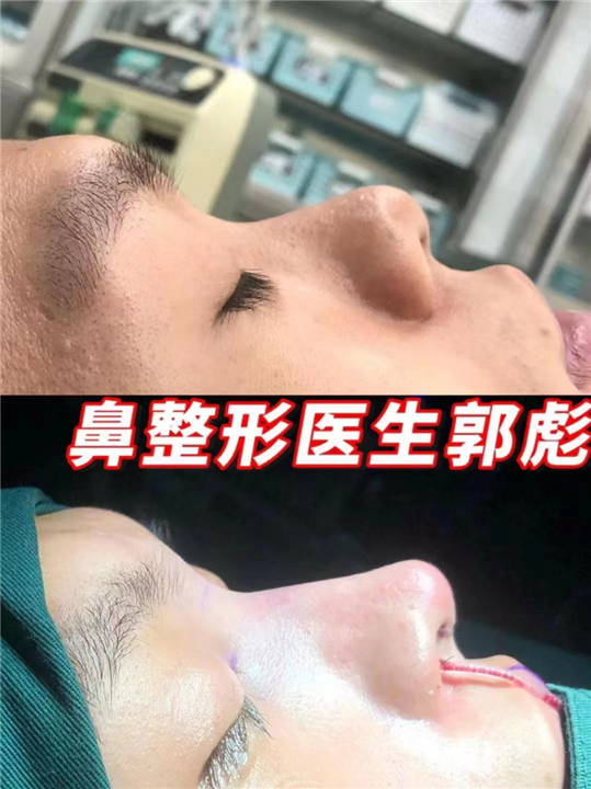 郭彪医生