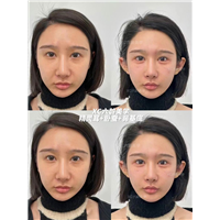 佐伊Zoe