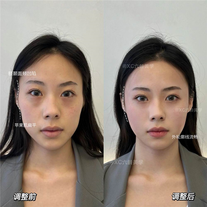 长沙磨骨专家