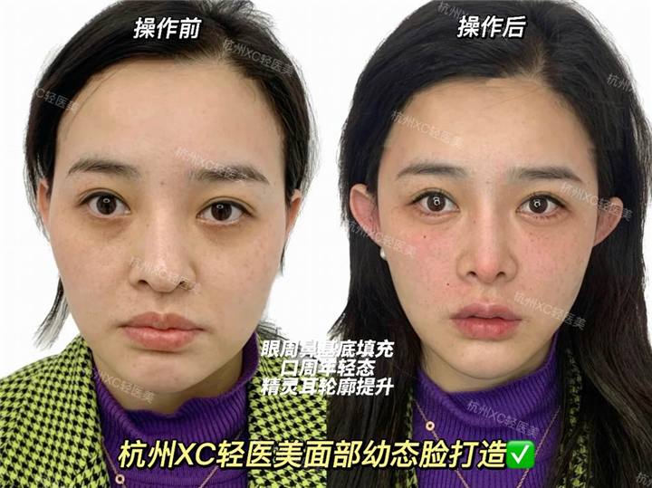 佐伊Zoe