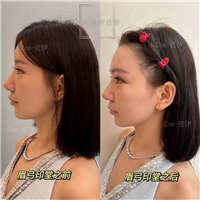 佐伊美学设计