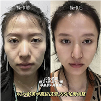 佐伊美学设计