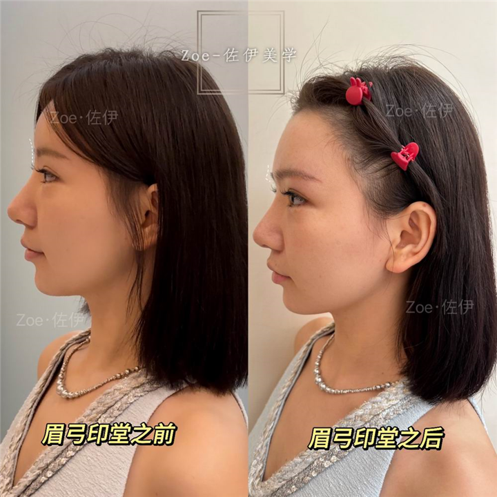佐伊美学设计