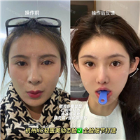 佐伊Zoe