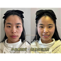 佐伊Zoe