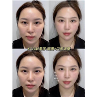 佐伊
