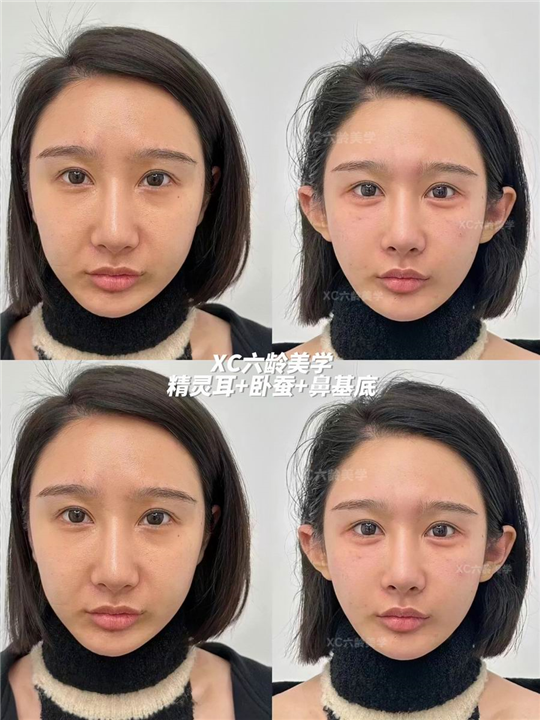 佐伊Zoe