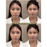 佐伊Zoe