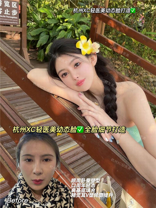 胡朝辉