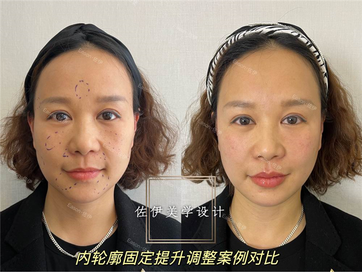 杭州星璨整形