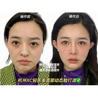 佐伊Zoe