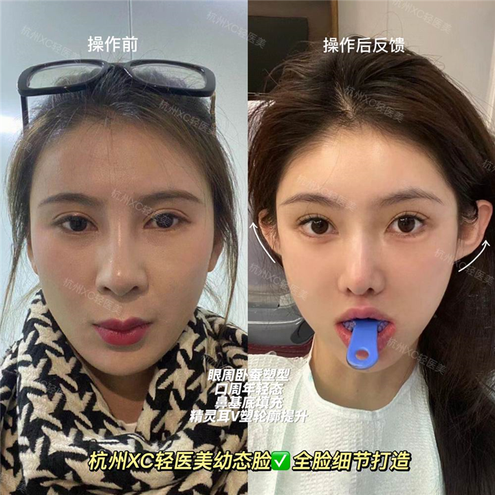 佐伊Zoe