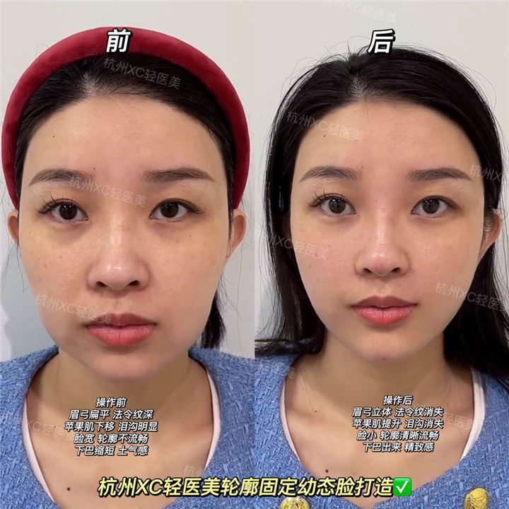 佐伊美学设计