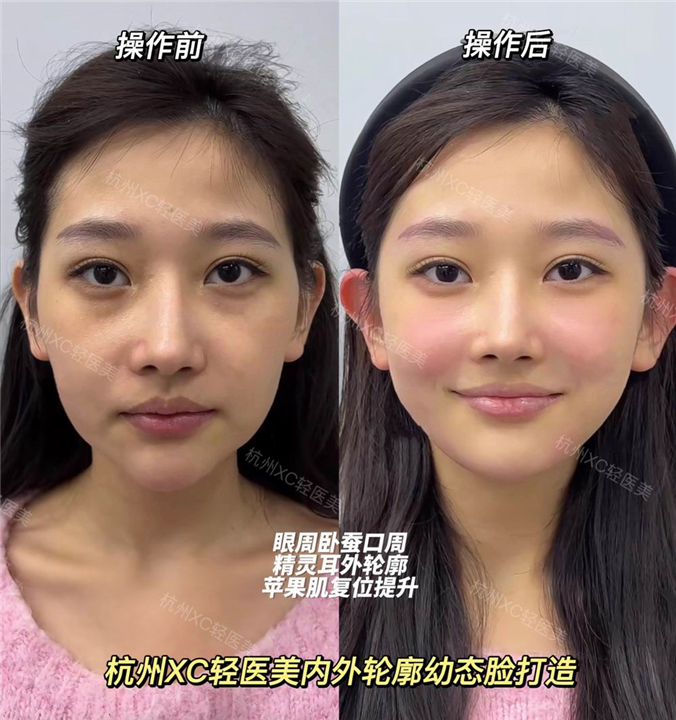 佐伊美学设计