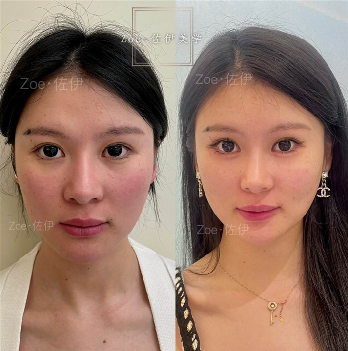 佐伊美学设计