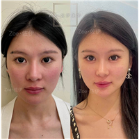 佐伊美学设计
