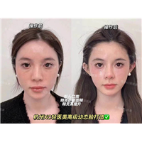 zoe佐伊