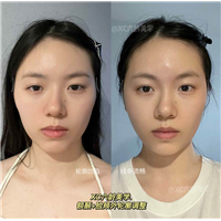 佐伊
