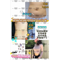 上海腰部吸脂整形医院 