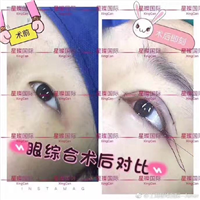 上海眼综合整形医院哪家好 