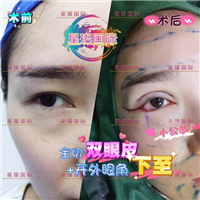 上海眼综合整形医院哪家好 