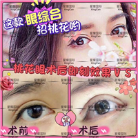 上海眼综合整形医院哪家好 