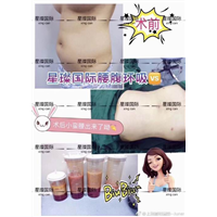 上海星璨吸脂减肥整形效果怎样 