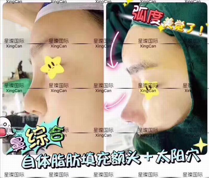 上海眼综合整形哪家好 
