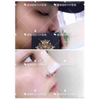上海星璨鼻综合整形医院 