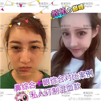 上海人气网红整形医院 