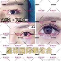 上海芭比眼综合整形医院 