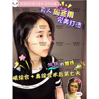 上海眼鼻综合整形哪家好 