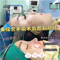 上海鼻部综合整形医院 
