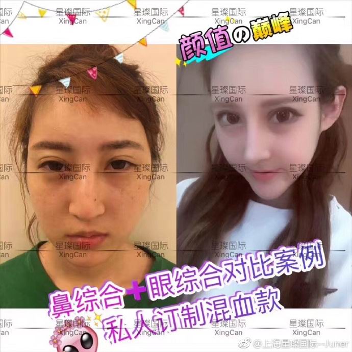 上海人气网红整形医院 