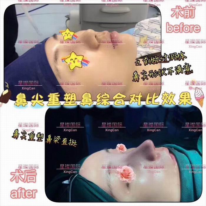 上海人气网红整形医院 