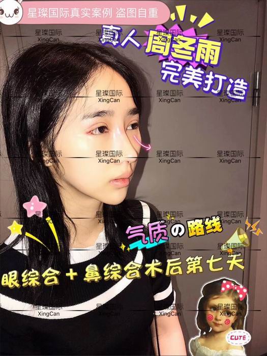 上海眼鼻综合整形哪家好 