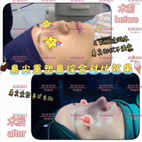 上海人气网红整形医院 