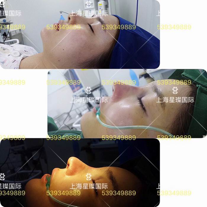 上海网红整形星璨医院 