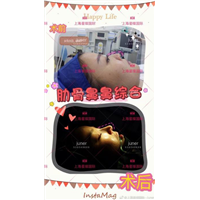 上海肋骨鼻综合整形医院 