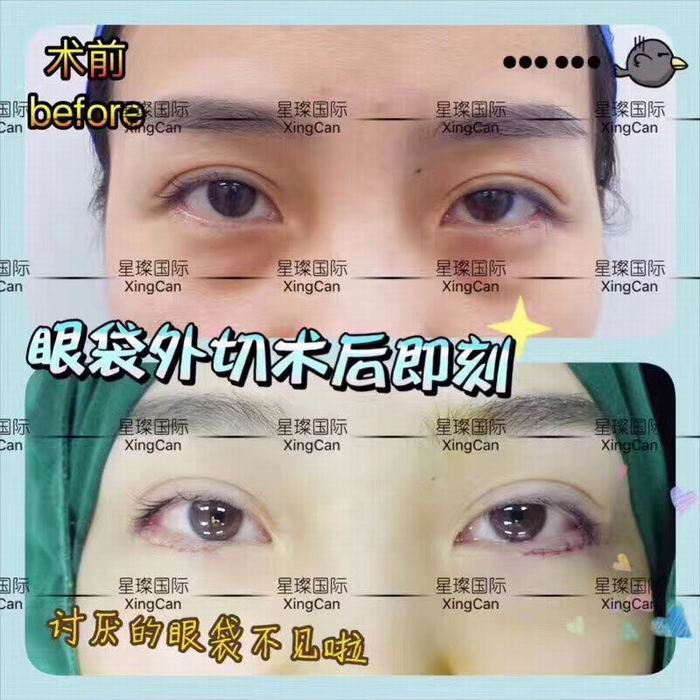 上海人气网红整形医院 