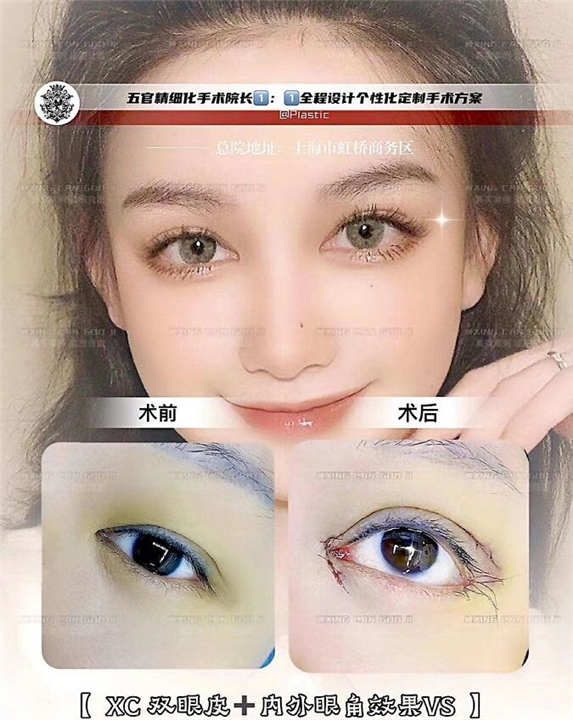 上海星璨眼综合