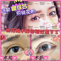 上海芭比眼综合整形医院 