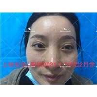 刘林奇修复