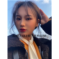 刘林奇修复