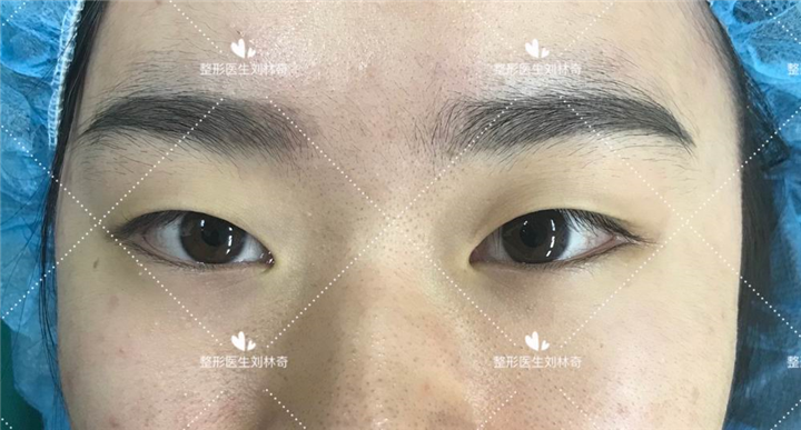 刘林奇医生