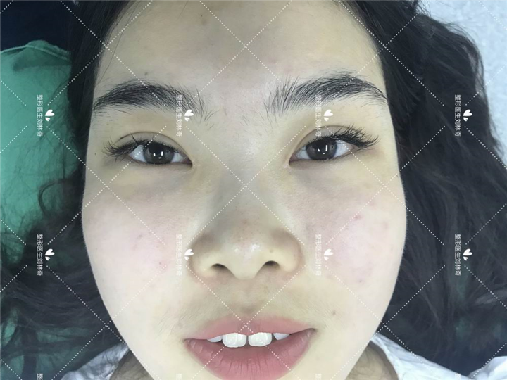 刘林奇整形