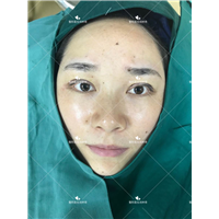 刘林奇修复