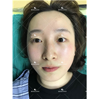 刘林奇医生