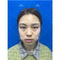 刘林奇厉害吗