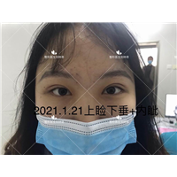 刘林奇修复